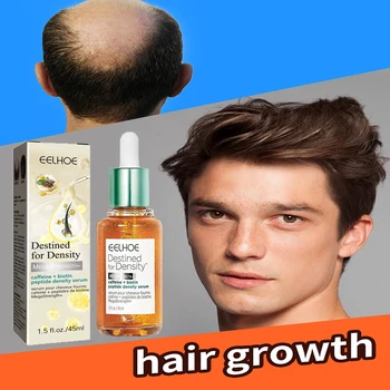 Восстановление волосяных фолликулов, Растительное эфирное масло для роста волос, быстрая регенерация волос, уход за кожей головы.