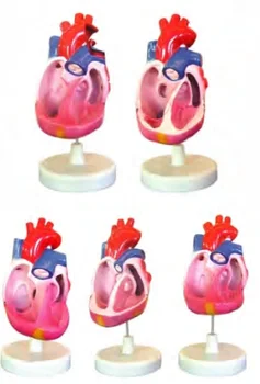 Модель врожденного порока развития сердца Усовершенствованный медицинский тренажер анатомии человека