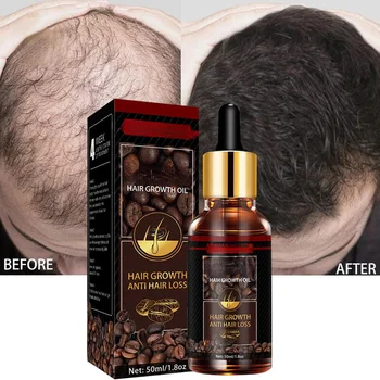 Эфирное масло для роста волос с кофеином Предотвращает выпадение волос, питает корни волос, восстанавливает волосы, способствует росту волос